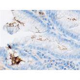 Immunopathology Control Slides Immunopath Helicobacter sp. Animal Pos ,10 / pk - Axiom Medical Supplies