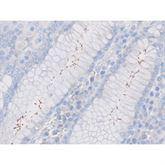 Immunopathology Control Slides Immunopath Helicobacter sp. Pos ,10 / pk - Axiom Medical Supplies