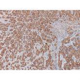 Immunopathology Control Slides E-cadherin Pos ,10 / pk - Axiom Medical Supplies