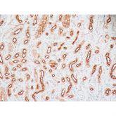 Immunopathology Control Slides Epithelial Membrane Antigen (EMA) Pos ,10 / pk - Axiom Medical Supplies