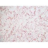 Immunopathology Control Slides Factor XIIIa Pos ,10 / pk - Axiom Medical Supplies