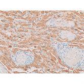 Immunopathology Control Slides Glial Fibrillary Acid Protein Pos ,10 / pk - Axiom Medical Supplies