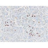 Immunopathology Control Slides Hepatitis B Core Antigen (HBcAG) Pos ,10 / pk - Axiom Medical Supplies