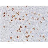 Immunopathology Control Slides Hepatitis B Surface Antigen(HBsAG) Pos ,10 / pk - Axiom Medical Supplies