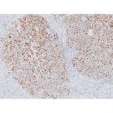 Immunopathology Control Slides HMB-45 Pos ,10 / pk - Axiom Medical Supplies