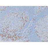 Immunopathology Control Slides Kappa Pos ,10 / pk - Axiom Medical Supplies