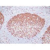 Immunopathology Control Slides Ki-67 Pos ,10 / pk - Axiom Medical Supplies