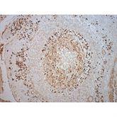 Immunopathology Control Slides Lambda Pos ,10 / pk - Axiom Medical Supplies