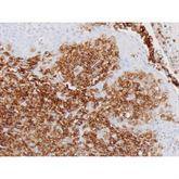 Immunopathology Control Slides CD45, Leucocyte Common Ant (LCA) Pos ,10 / pk - Axiom Medical Supplies