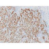 Immunopathology Control Slides Melan-A (MART-1) Pos ,10 / pk - Axiom Medical Supplies