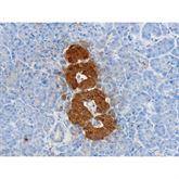 Immunopathology Control Slides Neuron-Specific Enolase (NSE) Pos ,10 / pk - Axiom Medical Supplies