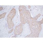 Immunopathology Control Slides p16 Pos ,10 / pk - Axiom Medical Supplies