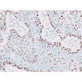 Immunopathology Control Slides p40 Pos ,10 / pk - Axiom Medical Supplies