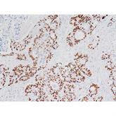 Immunopathology Control Slides p53 Pos ,10 / pk - Axiom Medical Supplies