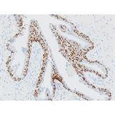 Immunopathology Control Slides p63 Pos ,10 / pk - Axiom Medical Supplies