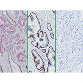 Immunopathology Control Slides CK5/14 + p63 + P504S Multi-Tissue Pos ,10 / pk - Axiom Medical Supplies