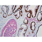 Immunopathology Control Slides CK5/14 + p63 + P504S Pos ,10 / pk - Axiom Medical Supplies