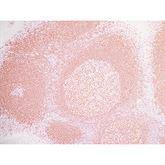 Immunopathology Control Slides PAX5 Pos ,10 / pk - Axiom Medical Supplies