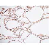 Immunopathology Control Slides PAX8 Pos ,10 / pk - Axiom Medical Supplies