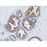 Immunopathology Control Slides Prostate Specific Antigen (PSA) Pos ,10 / pk - Axiom Medical Supplies