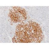 Immunopathology Control Slides S-100 Pos ,10 / pk - Axiom Medical Supplies