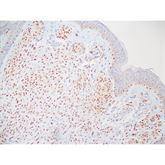 Immunopathology Control Slides SOX-10 Pos ,10 / pk - Axiom Medical Supplies