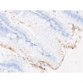 Immunopathology Control Slides Spirochete • Animal Pos ,10 / pk - Axiom Medical Supplies