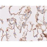 Immunopathology Control Slides Spirochete Treponema sp. Art. Pos ,10 / pk - Axiom Medical Supplies