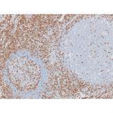 Immunopathology Control Slides CD3 • T-Cell Pos ,10 / pk - Axiom Medical Supplies