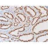 Immunopathology Control Slides Thyroid Transcr Factor (TTF-1) Pos ,10 / pk - Axiom Medical Supplies