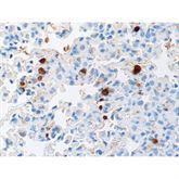 Immunopathology Control Slides Toxoplasma sp. • Animal Pos ,10 / pk - Axiom Medical Supplies