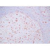 Immunopathology Control Slides Vimentin Pos ,10 / pk - Axiom Medical Supplies