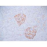 Immunopathology Control Slides Wilms' Tumor (WT1) Pos ,10 / pk - Axiom Medical Supplies