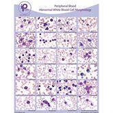 Peripheral Blood Cards and Posters Abnormal WBC Morphology Poster ,1 Each - Axiom Medical Supplies