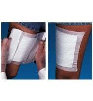 MPM Medical Adhesive Dressing WoundGard® 6 X 6 Inch Gauze Square White Sterile