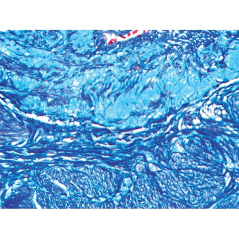 Mallory Trichrome Stain Kit Pint Kit ,1 Each - Axiom Medical Supplies