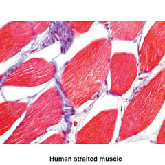 Masson 2000 Trichrome Stain Kit Trichrome Control Slides ,Pack oF 25 - Axiom Medical Supplies