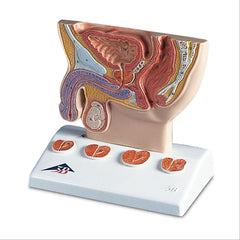 Men's Health Prostate Model Prostate Model • 1/2 Natural Size ,1 Each - Axiom Medical Supplies