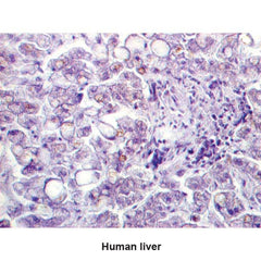 Microwave Copper Stain Kit 100mL Kit ,1 Each - Axiom Medical Supplies