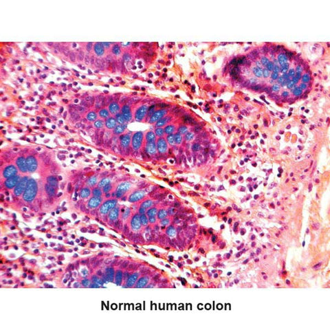 Modified Genta Triple Stain Kit Helicobacter Pylori Control Slides ,Pack oF 25 - Axiom Medical Supplies