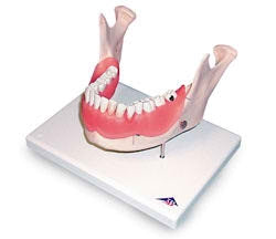 Nasco Dental Disease Teeth Model Adult