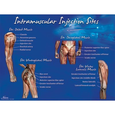 Nasco Educational Poster Intramuscular Injection Sites Training Poster 18 X 24 Inch Heavy Paper Grommets Laminated