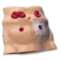 Nasco Ostomy Care Model Synthetic Tissue