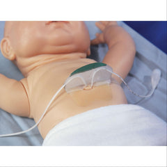 NeoBridge Umbilical Catheter Holder Large • Approx Weight: 1,200-2,200g ,20 / pk - Axiom Medical Supplies
