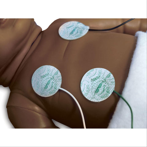 NeoLead ECG Electrodes Micro ,20 / pk - Axiom Medical Supplies