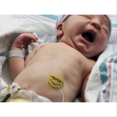 NeoSmile Temperature Probe Cover NeoSmile" Temperature Probe Cover • 1" Dia ,150 / pk - Axiom Medical Supplies