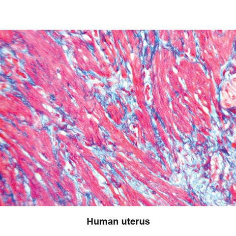 One-Step Trichrome Blue and Red Stain Kit Pint Kit ,1 Each - Axiom Medical Supplies