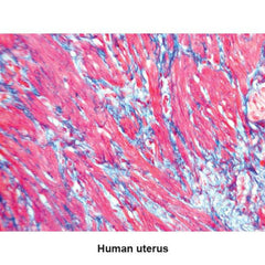 One-Step Trichrome Blue and Red Stain Kit Pint Kit ,1 Each - Axiom Medical Supplies