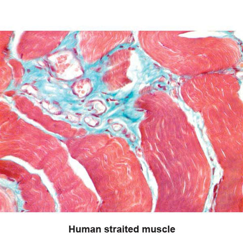 One-Step Trichrome Green and Red Stain Kit Pint Kit ,1 Each - Axiom Medical Supplies