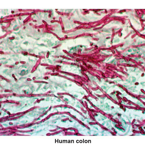 PAS Stain Kit Mast Cell Control Slides ,Pack oF 25 - Axiom Medical Supplies
